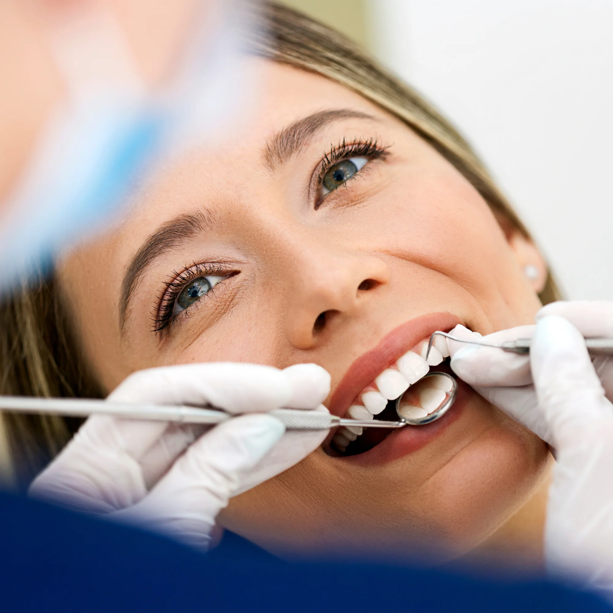 Limpieza Dental con Pulido y Aplicación de Fluor por $14.99 en Clínica Dental La Sonrisa PTY