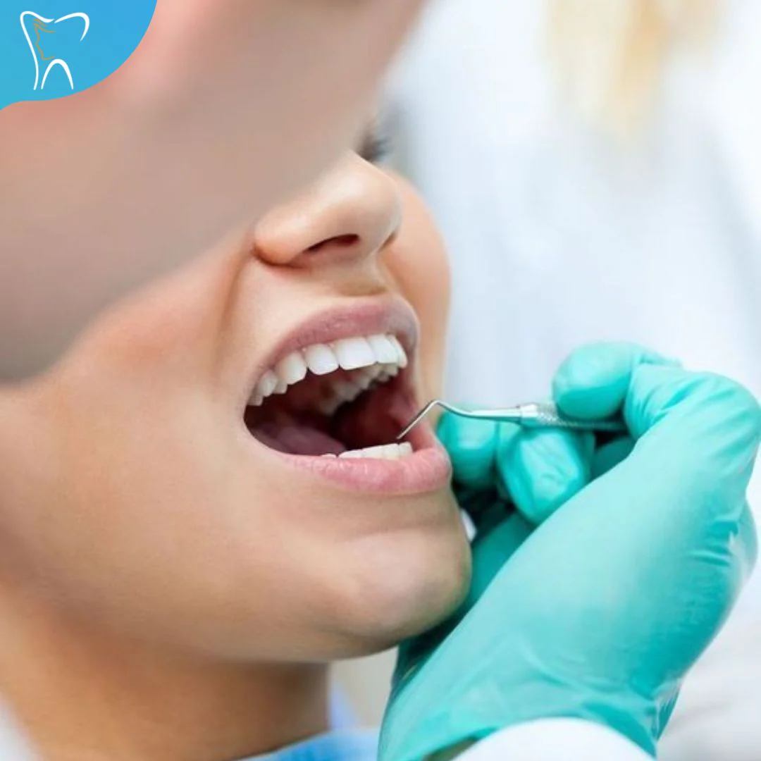 Blanqueamiento Dental Profesional + Limpieza + Evaluación por $75 en Total Care - Image 3